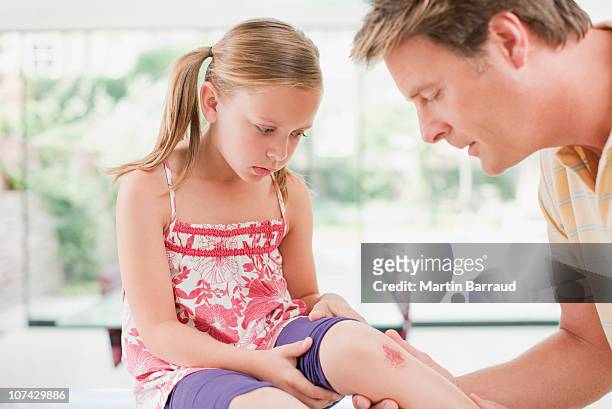 father tending to daughters scraped knee - wounded stockfoto's en -beelden