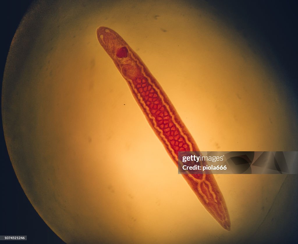 Trmatode Trematode Under A Microscope High-Res Stock Photo - Getty Images
