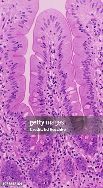 a villus in the small intestine (human ileum), simple columnar epithelium with goblet cells, 50x - lamina propria fotografías e imágenes de stock