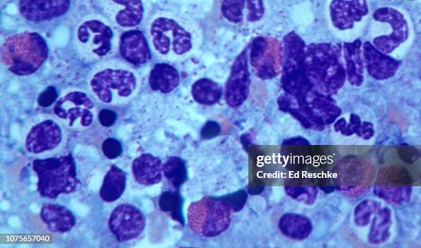Created Rbc Histo 100 White Blood Cell Histology Stock Photos, High-Res Pictures, and ...