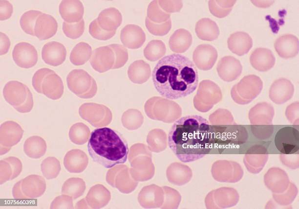 human blood cells--leukocytes (white blood cells), erythrocytes (red blood cells), and thrombocytes (platelets), 400x - granulocita neutrofilo foto e immagini stock