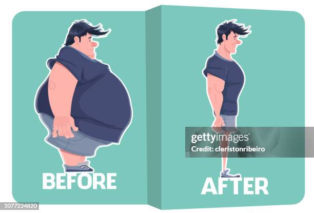 before and after (weight loss) - abdomen surgery stock illustrations