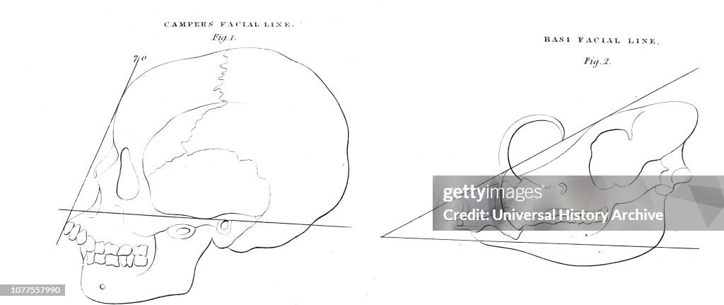 A sketch showing the facial and basi-facial angles used by Petrus Camper.
