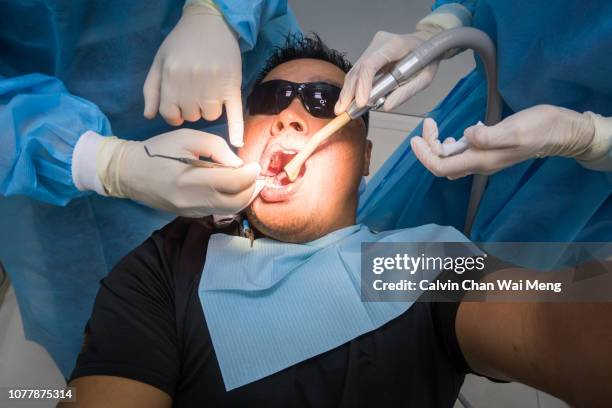 selfie - dental treatment - root canal stock pictures, royalty-free photos & images