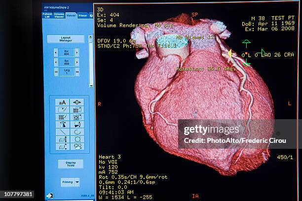 computer monitor displaying cat scan image of heart - tomography stock pictures, royalty-free photos & images