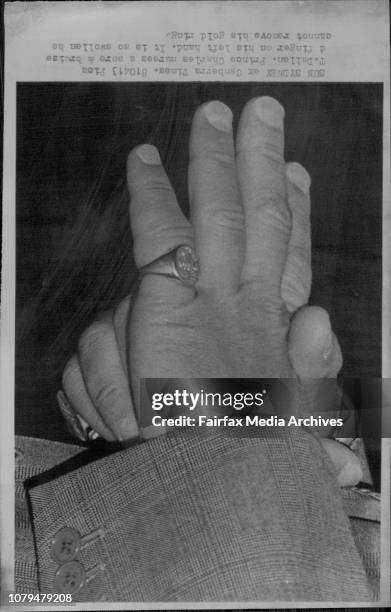 Prince Charles nurses a sore &amp; bruise d finger on his left hand. It is so swollen he cannot remove his gold ring.The little finger of Prince...