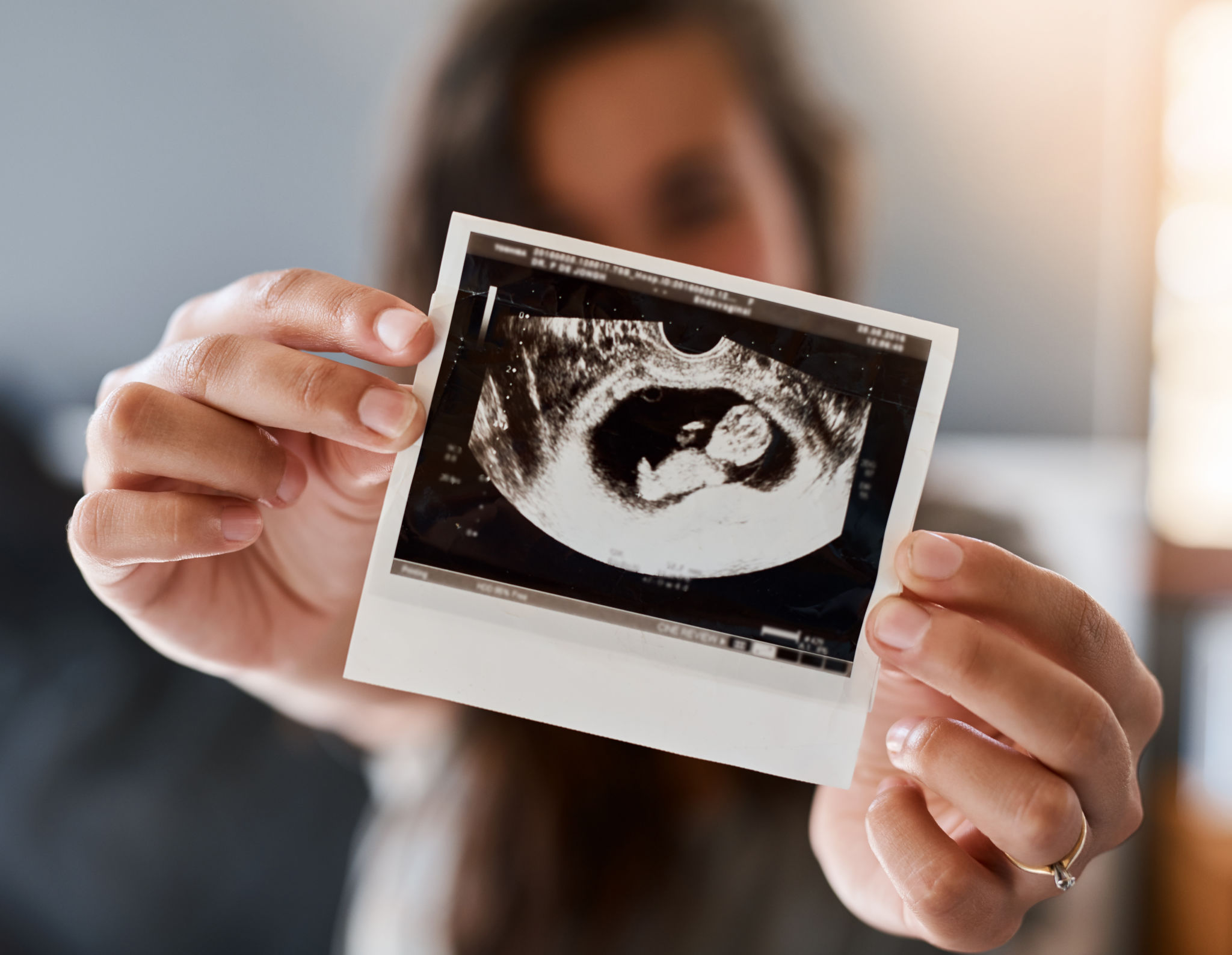 maternity photography