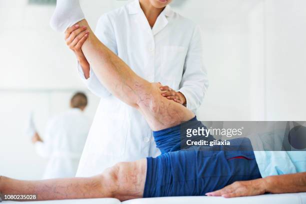 senior vrouw met spataderen been aderen bij spreekkamer. - atheromatose stockfoto's en -beelden