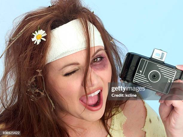 woman with black eye - bruise stock pictures, royalty-free photos & images