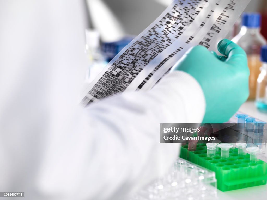Close-up of scientist holding DNA gel by samples for testing in laboratory