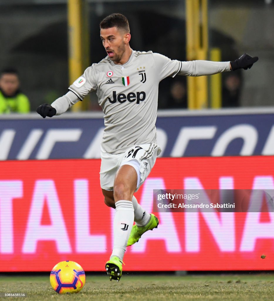 Bologna FC v Juventus - Coppa Italia