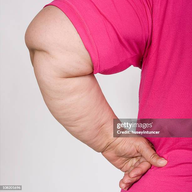 portrait of obese woman's arm - stretch mark stock pictures, royalty-free photos & images