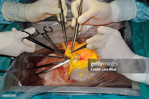 kidney transplant in operating room - plastic surgery stockfoto's en -beelden