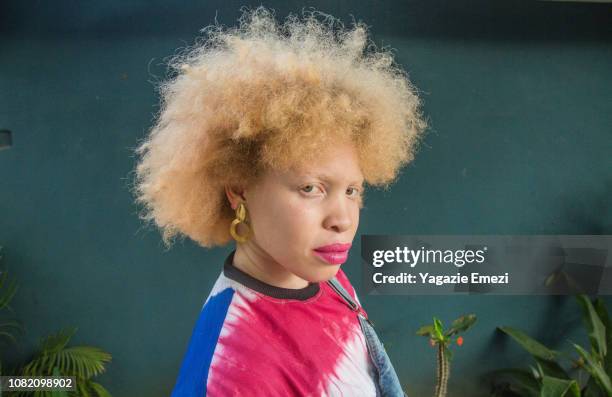 woman looking at camera - albino stock pictures, royalty-free photos & images