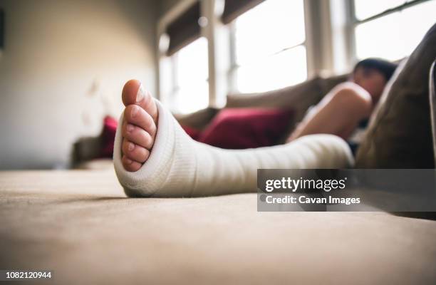 close-up of boy with fractured leg sitting on sofa at home - broken leg stock-fotos und bilder