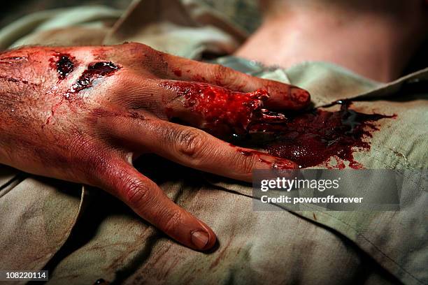 military man with severed finger - hand laceration stockfoto's en -beelden