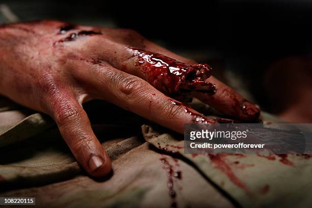 homem com dedo cortada militar - hand injury - fotografias e filmes do acervo
