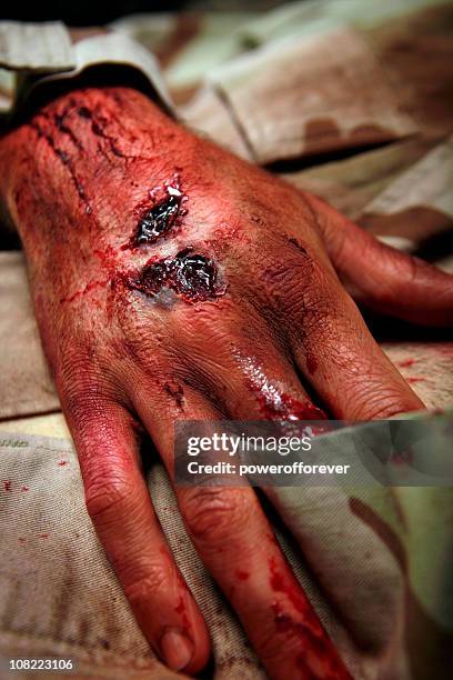 military man with burns and lesions - injured us army stock pictures, royalty-free photos & images