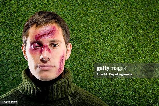 young man lying in grass with cuts on face - victim stock pictures, royalty-free photos & images