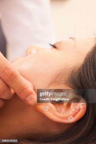 chinese doctor using acupuncture on patient - woman fingers in ears stock pictures, royalty-free photos & images