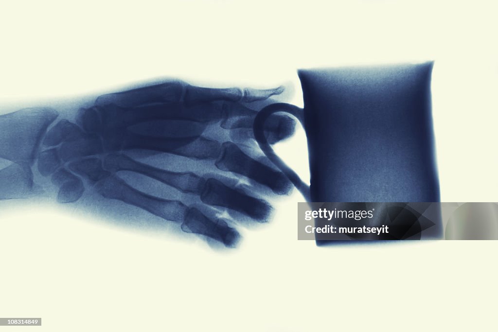 X-ray image with a hand and cup of coffee XXXL