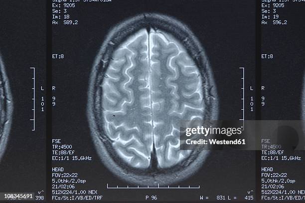 x-ray image head, close up - imagen de rayos x fotografías e imágenes de stock