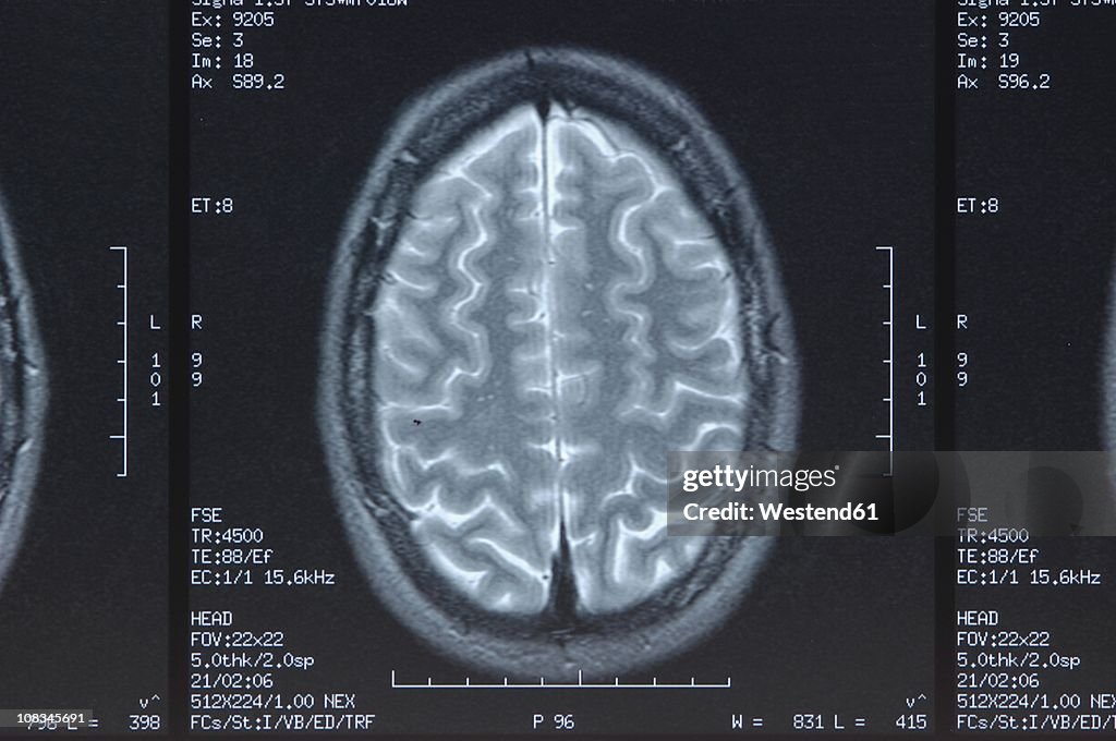 X-ray image head, close up