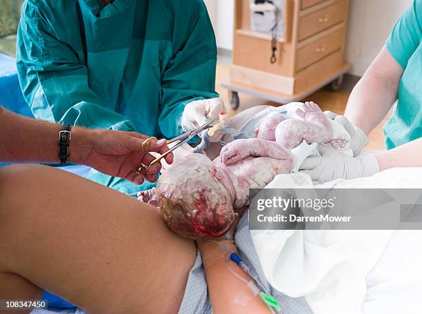 birth of a baby - umbilical cord stock pictures, royalty-free photos & images