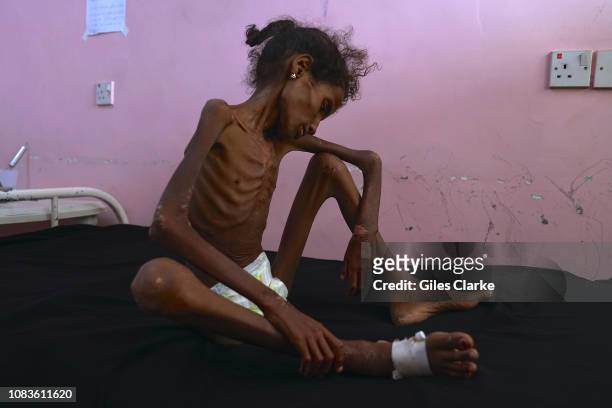 Abrar, aged 12, was admitted to the hospital on December 4th 2018 having been driven overnight from her hometwon and frontlines of Al Hudaydah, the...