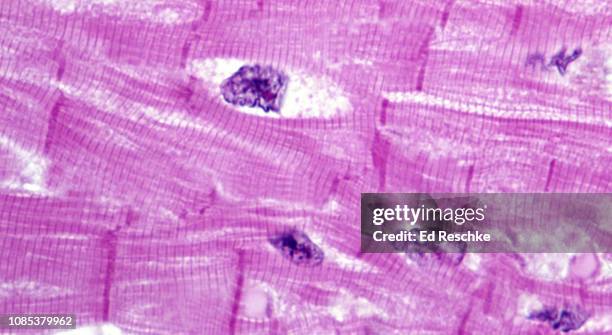 cardiac muscle--striations, intercalated disks, nuciei and syncytial nature, 250x - trofoblasto sincicial imagens e fotografias de stock