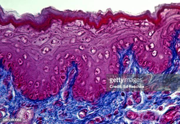 stratified squamous epithelium--keeratinized, epidermis of skin, 200x - plaveiselcelepitheel stockfoto's en -beelden