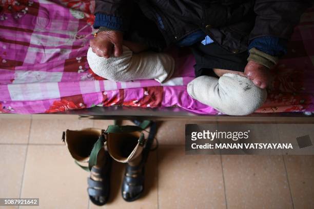 This picture taken on January 20, 2019 shows a disabled leprosy survivor sitting on his bed at the Van Mon Leprosy hospice compound, northern...