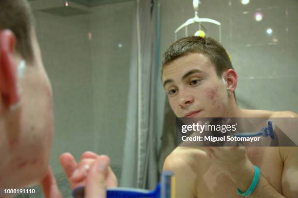 teen with acne shaving - spain teen face bildbanksfoton och bilder