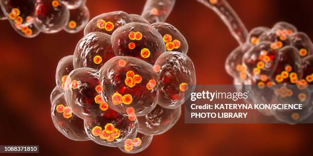 staphylococcal pneumonia, illustration - bronchialbaum stock-grafiken, -clipart, -cartoons und -symbole