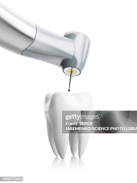 dental treatment, conceptual illustration - zahnarzt stock-grafiken, -clipart, -cartoons und -symbole
