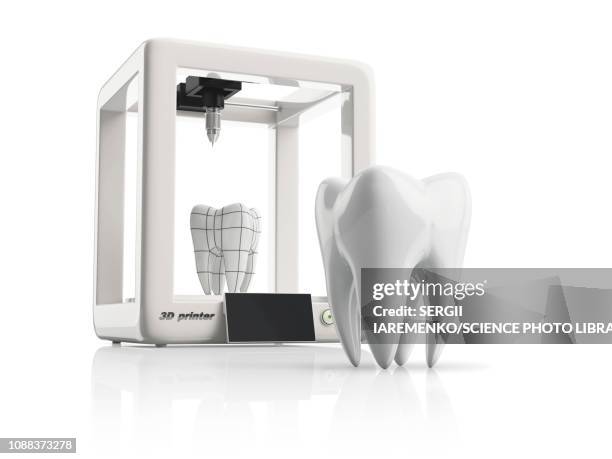 3d model of tooth, illustration - 3d printing点のイラスト素材／クリップアート素材／マンガ素材／アイコン素�材