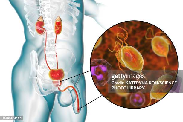 trichomoniasis, illustration - anatomical model stock illustrations