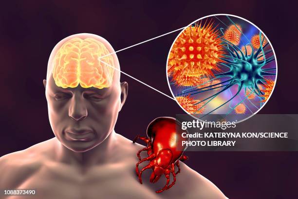 tick-bourne encephalitis, illustration - encephalitis stock illustrations