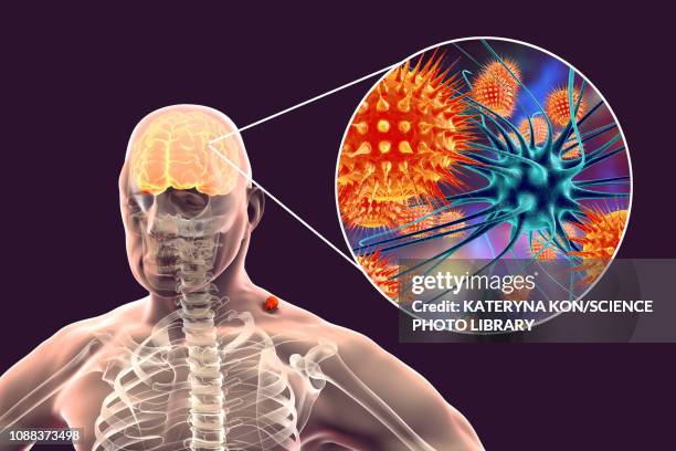 Brain Insect Parisite Animation Parasite Brain Photos and Premium High Res Pictures - Getty Images