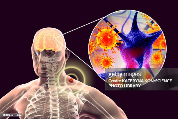 Brain Insect Parisite Animation Ilustraciones, imágenes clip art, dibujos animados e iconos de stock de ...