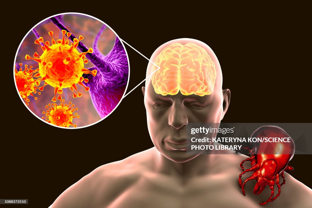 Tick-bourne encephalitis, illustration