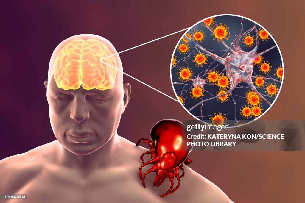 Tick-bourne encephalitis, illustration