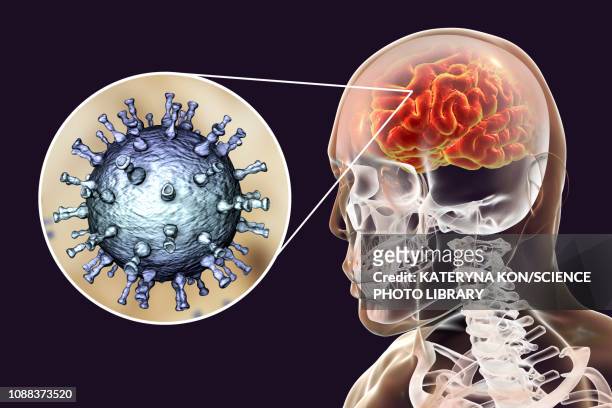 ilustraciones, imágenes clip art, dibujos animados e iconos de stock de encephalitis caused by varicella zoster virus, illustration - herpes zoster