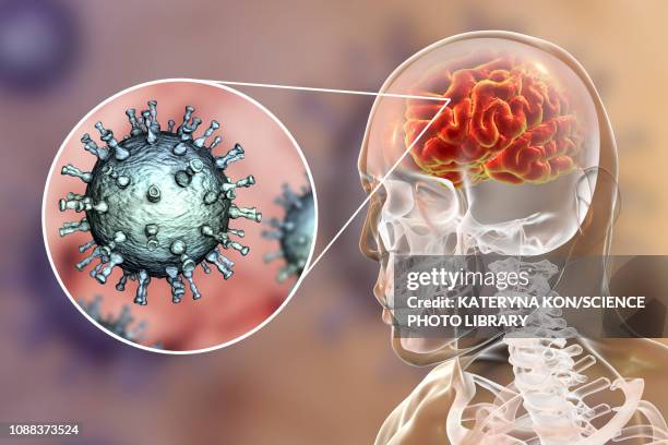 encephalitis caused by varicella zoster virus, illustration - varicella zoster virus stock illustrations