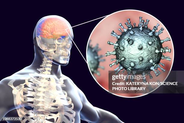 ilustraciones, imágenes clip art, dibujos animados e iconos de stock de encephalitis caused by varicella zoster virus, illustration - herpes zoster