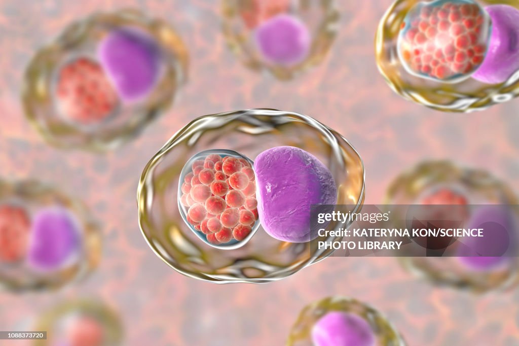 Chymadia Chlamydia Trachomatis