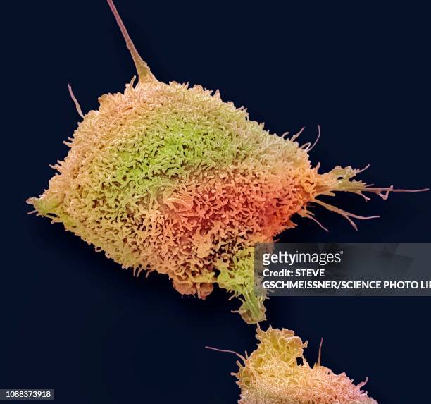 cervical cancer cell, sem - micrografía electrónica escaneadora fotografías e imágenes de stock