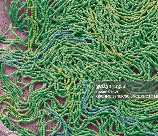 sputum culture, sem - mucus stock pictures, royalty-free photos & images