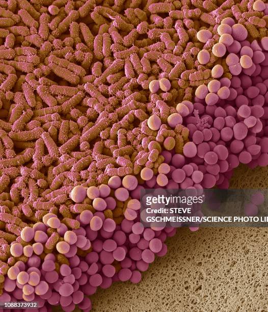 faecal bacteria, sem - scanning electron micrograph stock pictures, royalty-free photos & images