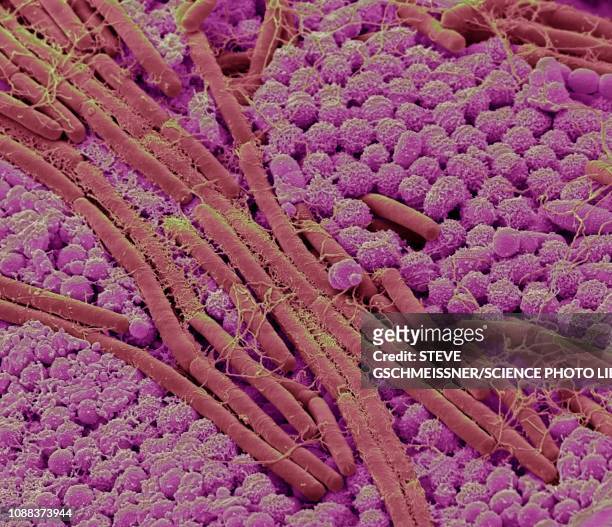 tongue bacteria - microscopia eletrônica de varredura - fotografias e filmes do acervo